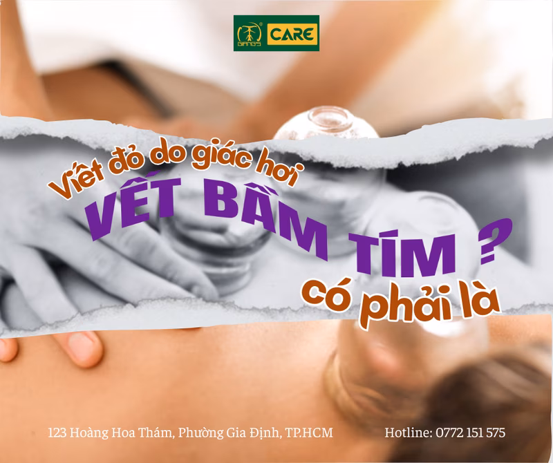 VẾT ĐỎ DO GIÁC HƠI CÓ PHẢI LÀ VẾT BẦM TÍM?